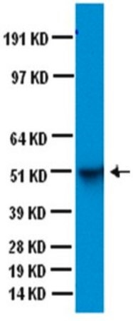 MAB3402 Anti-Glial Fibrillary Acidic Protein Antibody, clone GA5