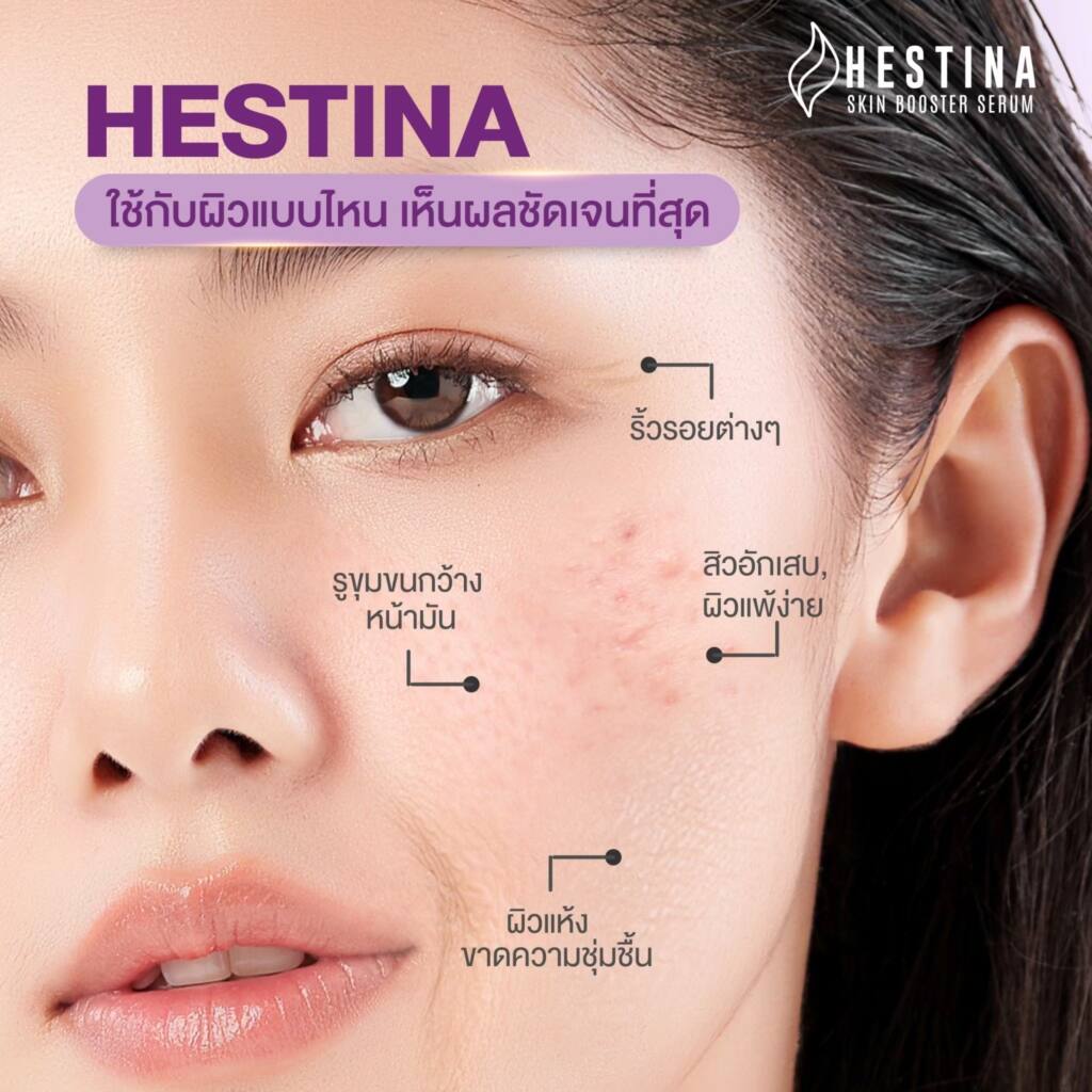 Hestina skin booster serum เมโสที่เพิ่มความชุ่มชื้นให้ผิวถึงขีดสุด ฉ่ำใส ลดสิว ผิวแข็งแรง 1 กล่อง 10 ขวด