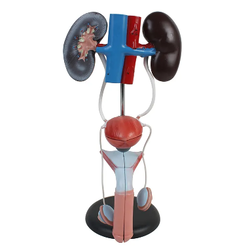 แบบจําลองของระบบปัสสาวะชาย