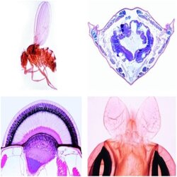 Insects(Insecta), Enlarged Basic Set, 40 Microscope Slides