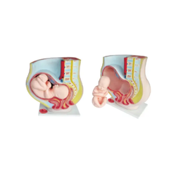 แบบจำลองการตั้งครรภ์ในมดลูกของมนุษย์