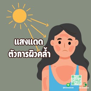 แสงแดดตัวการผิวคล้ำ